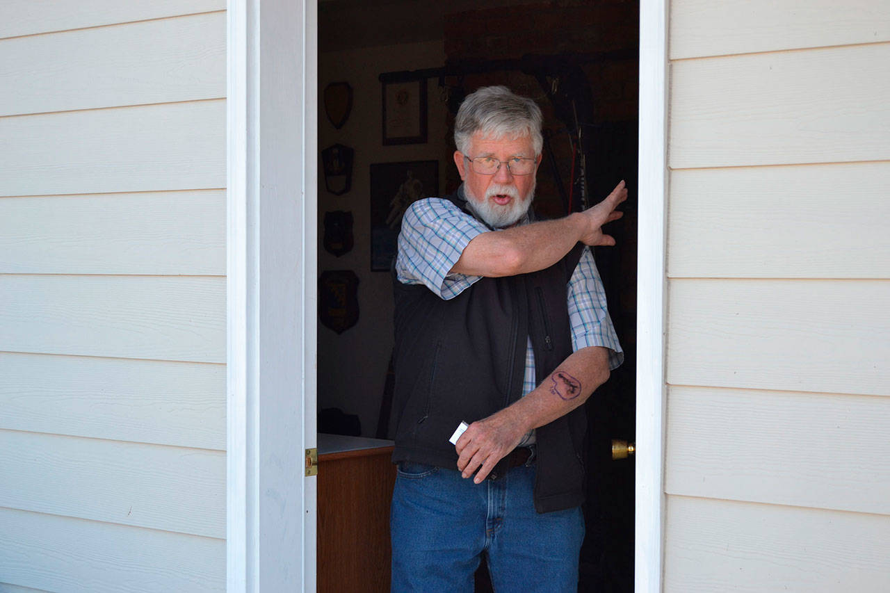 Terry Moore, 74, describes how three pit bulls attacked him outside his home Sept. 23. Two dogs have been euthanized so far and a third one is scheduled to be put down soon after being declared “dangerous” by city officials. (Matthew Nash /Olympic Peninsula News Group)