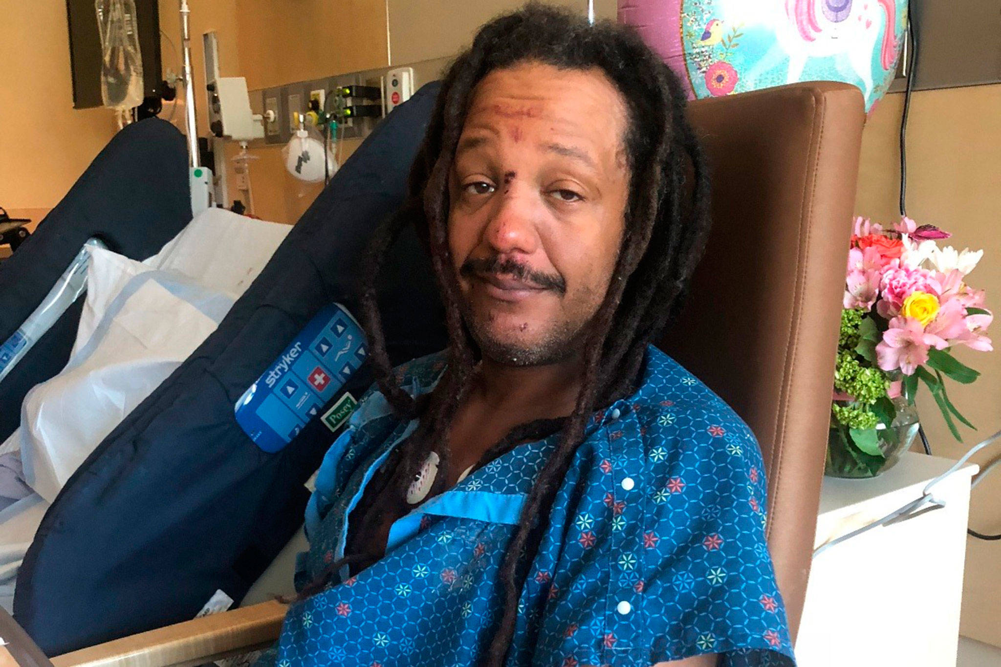 Joe Allen Jr., of Port Angeles continues to recuperate in Wenatchee after he was struck in the back of the head with a rock at a Phish concert in the Gorge Amphitheater on July 21.