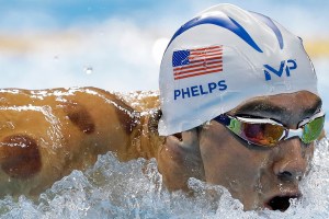Here’s why U.S. swimmer Michael Phelps has those spots on his body