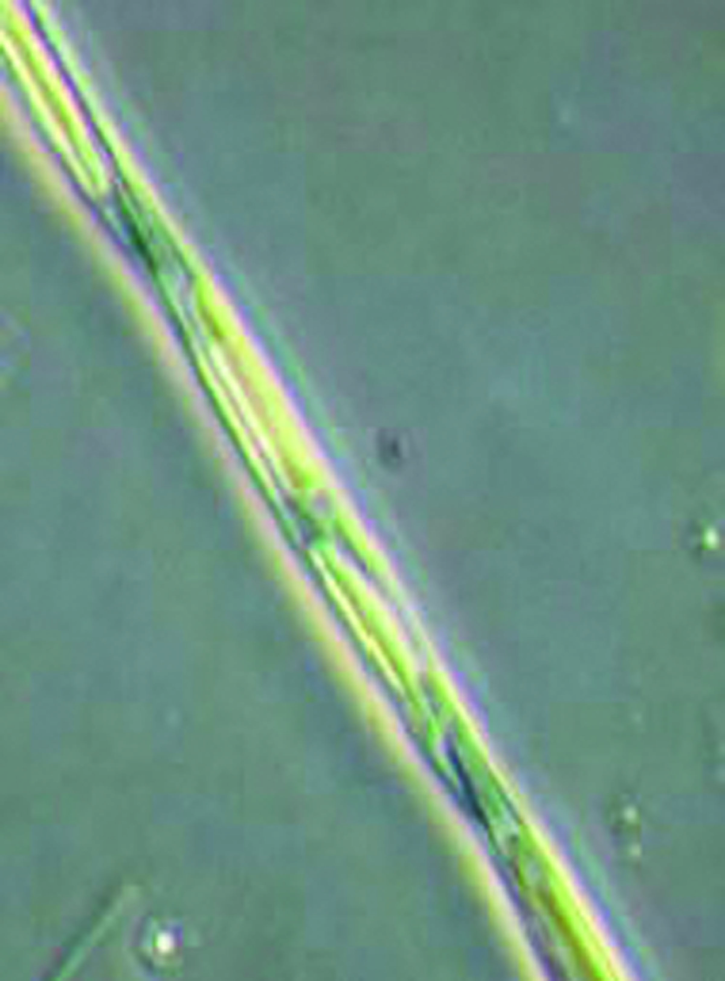 The marine algae Pseudo-nitzschia can at times create domoic acid.  Washington Department of Fish and Wildlife