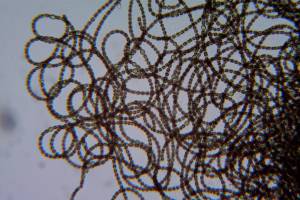 Anderson Lake closed due to nerve toxin