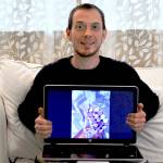 Pastor Tony Brown of Trinity United Methodist Church in Port Townsend holds an image of Walter Maphalala, a young man with albinism living in Swaziland, in February. (Jeannie McMacken/Peninsula Daily News)
