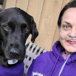 Melissa Smith of Sequim, pictured with Aulani, is recovering in Seattle from lungs and liver transplant surgery.