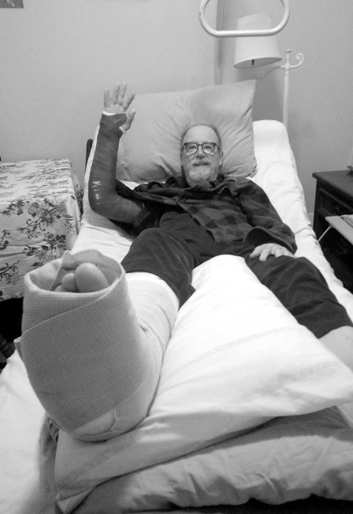 how I look today with my two casts.