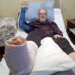 How I look today with my two casts. (Courtesy photo)