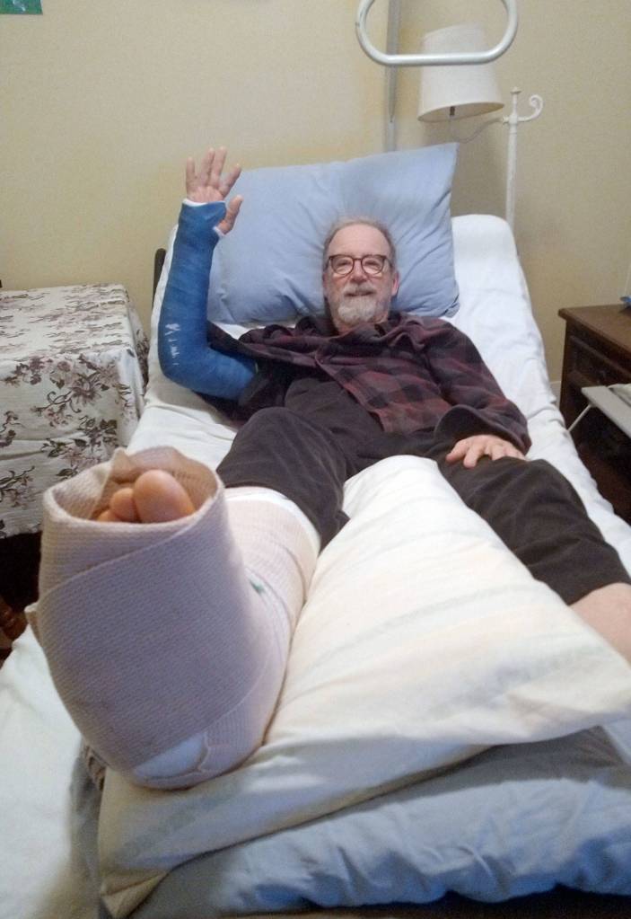 How I look today with my two casts. (Courtesy photo)