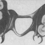 Dental piece found in body discovered at Lake Crescent.